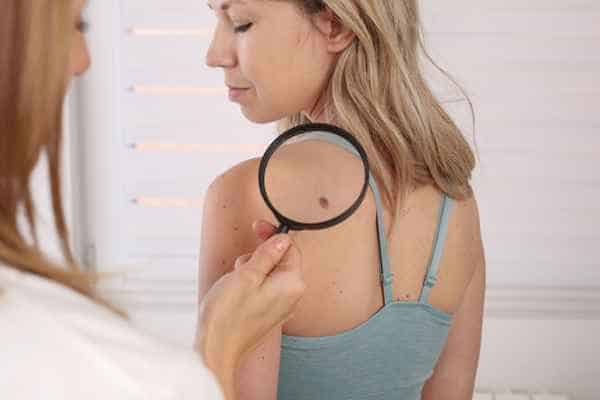 What Are Traditional Skin Lesion Removal Methods Northwood?