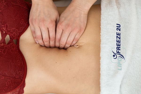 diastasis recti treatment Northwood