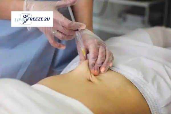 How Does Aqualyx Fat Dissolving Injection Work to Break Down Fat Northwood?