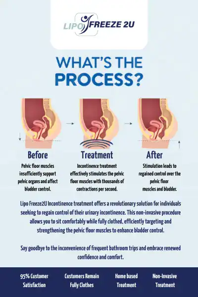 Diagram of how incontinence treatment Northwood works.