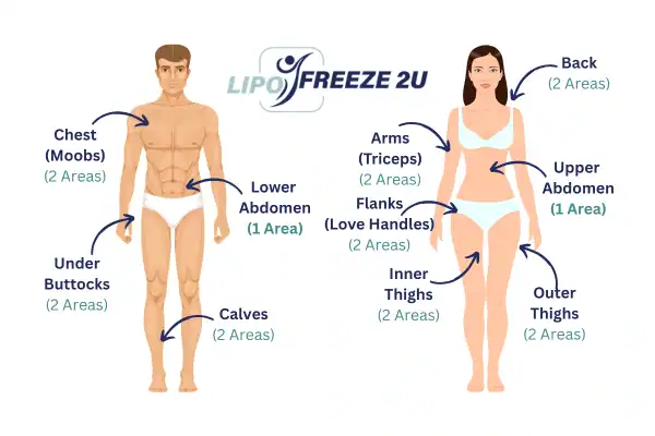 Areas you can have fat freezing treatment Northwood