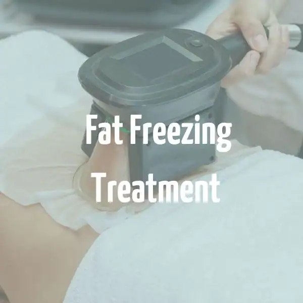 fat freezing treatment Northwood