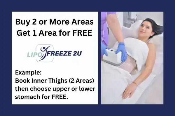 fat freezing prices Northwood