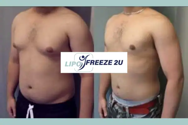 How Long Does It Take to See Results Northwood?