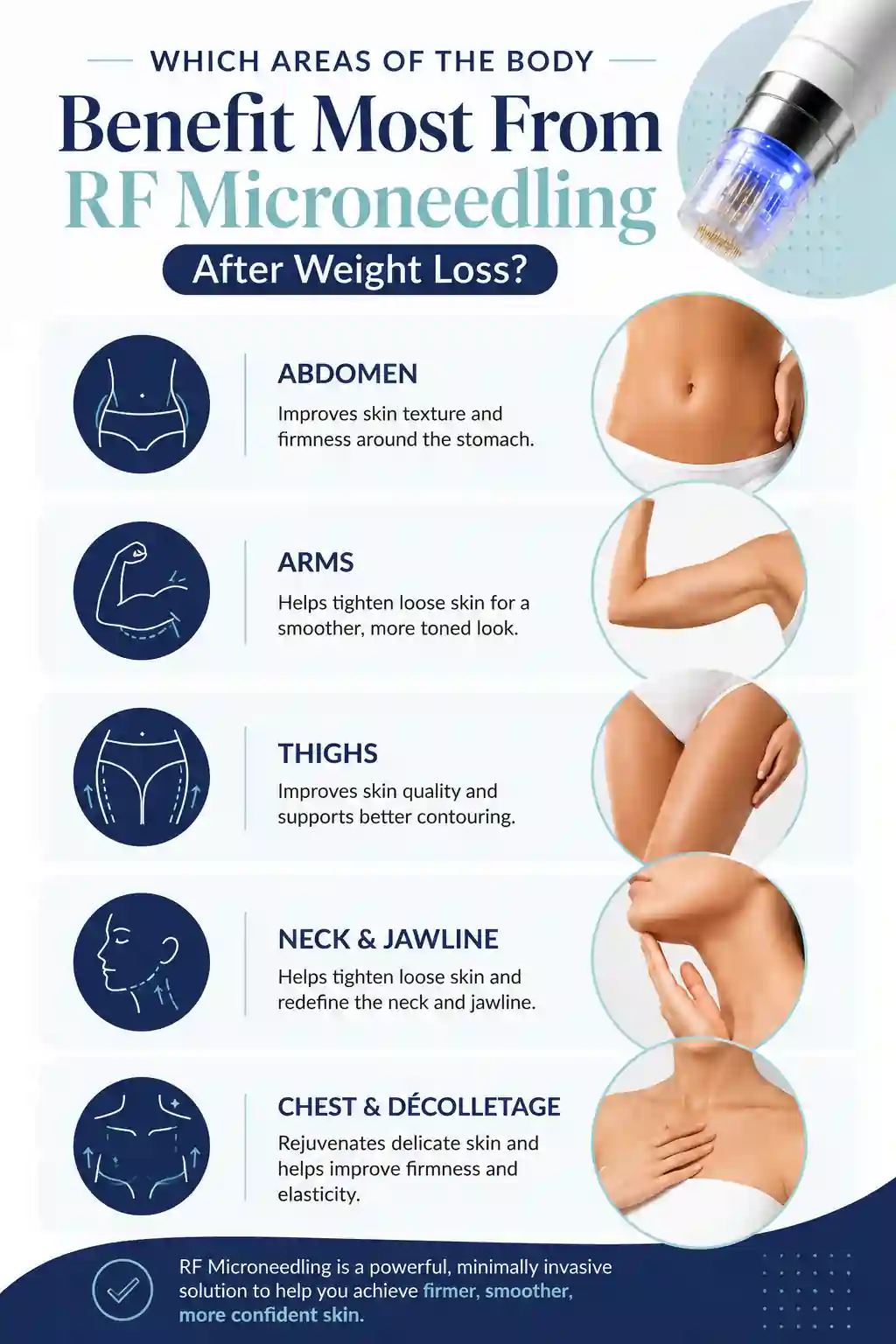 Which Areas of the Body Benefit Most From RF Microneedling After Weight Loss Northwood